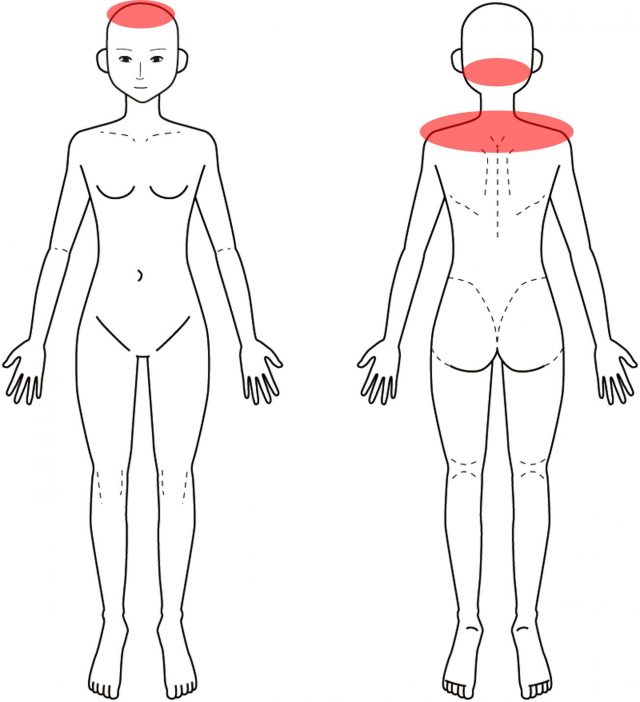 頭痛肩こり猫背